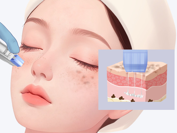韓國Cellin賽琳皮膚科價目表公開：江南站店皮膚管理、肉毒、皮秒與拉提價格參考