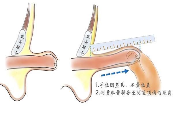韓國世檀塔男科醫院怎麼樣?