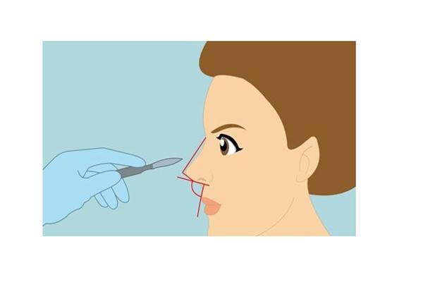 韓國首爾江南區GNG醫院隆鼻技術怎麼樣？功能鼻+美學隆鼻是它比較突出的方向