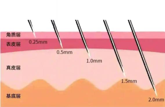 Which INTRAcel Clinic in Korea Should You Compare? 10 Seoul Clinics and 2026 Price Guide
